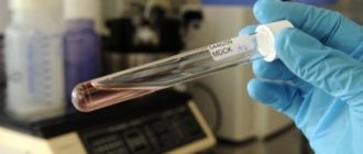 Вирус оспы обезьян добрался до России
